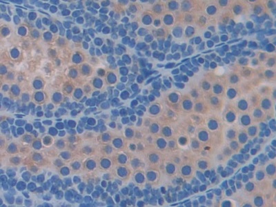 Polyclonal Antibody to Ferritin, Mitochondrial (FTMT)
