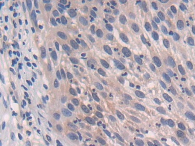 Polyclonal Antibody to Cytochrome P450 Reductase (CPR)