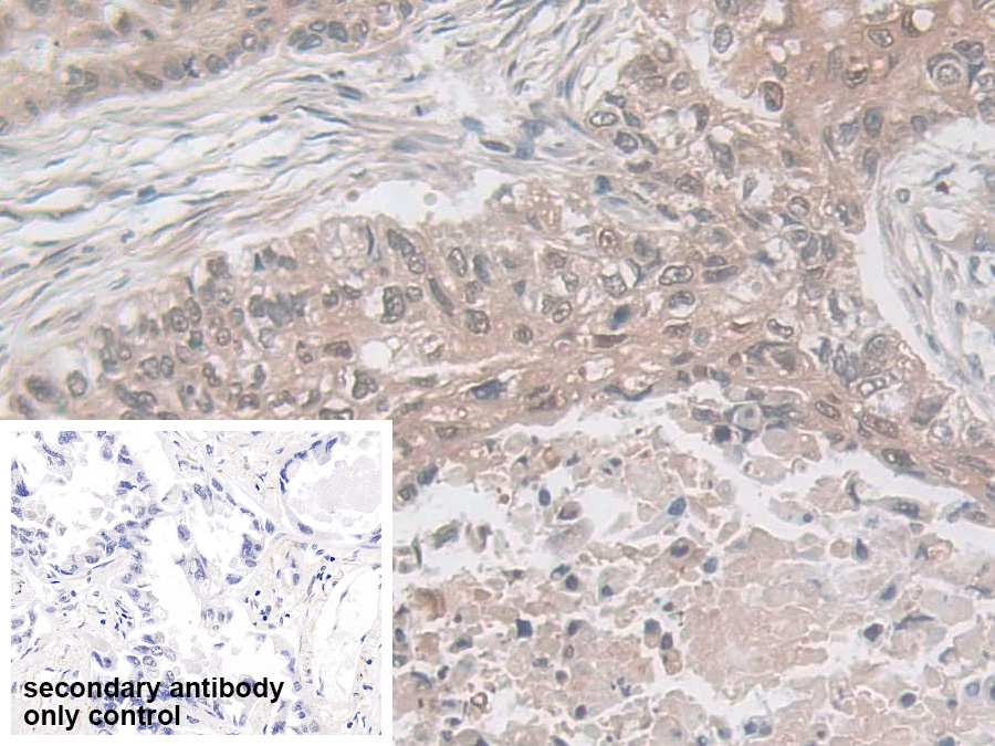 Polyclonal Antibody to Mammary Serine Protease Inhibitor (Maspin)
