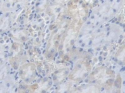 Polyclonal Antibody to Phosphofructokinase, Muscle (PFKM)