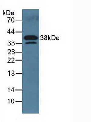 Polyclonal Antibody to Dickkopf Related Protein 3 (DKK3)