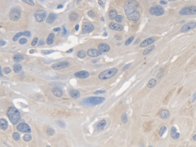 Polyclonal Antibody to Survival Of Motor Neuron 2, Centromeric (SMN2)