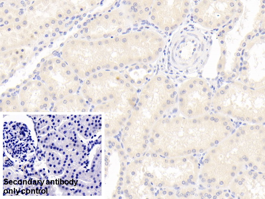 Polyclonal Antibody to Serum Amyloid A4, Constitutive (SAA4)