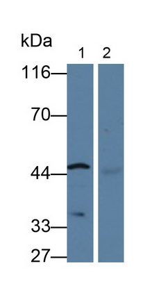 Polyclonal Antibody to Cytochrome P450 26A1 (CYP26A1)