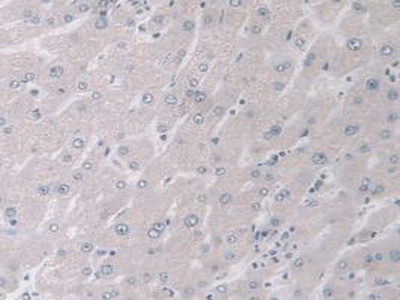 Polyclonal Antibody to Mitogen Activated Protein Kinase 12 (MAPK12)