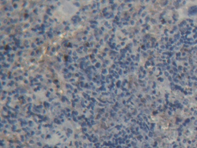 Polyclonal Antibody to Protein Tyrosine Phosphatase Receptor Type A (PTPRA)