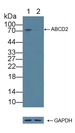 Polyclonal Antibody to ATP Binding Cassette Transporter D2 (ABCD2)