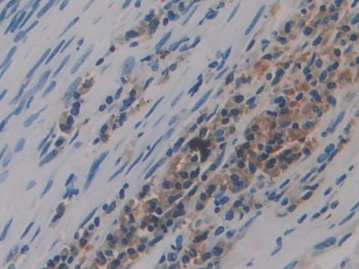 Polyclonal Antibody to Preprovasopressin (VP)