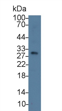 Polyclonal Antibody to Tryptase Beta 2 (TPSb2)