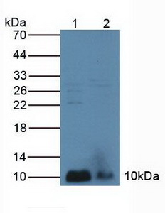 Polyclonal Antibody to Phospholipase A2, Group IIA (PLA2G2A)