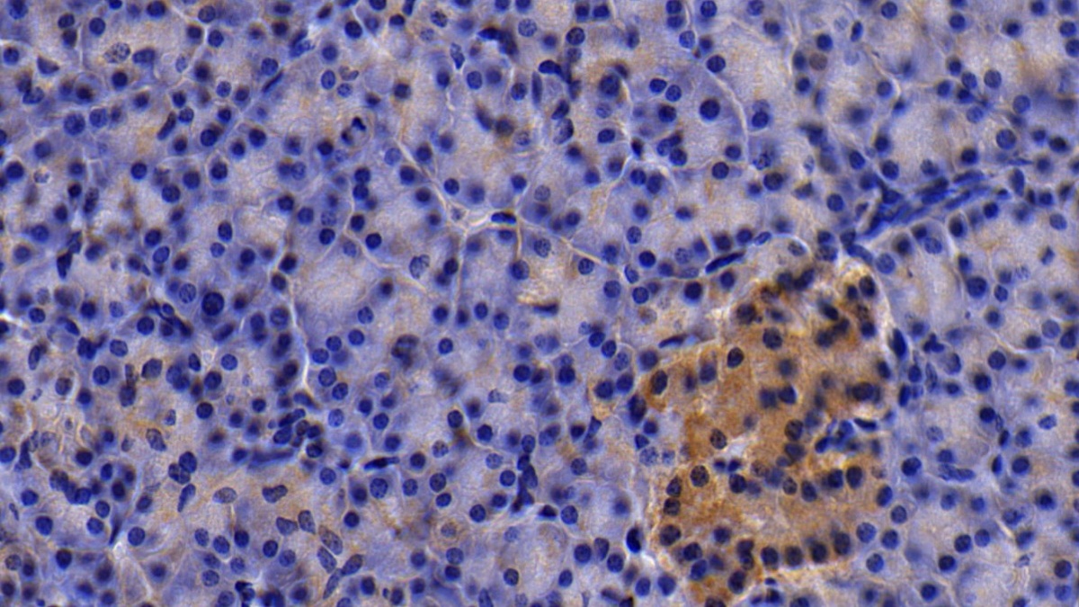 Polyclonal Antibody to Tumor Necrosis Factor Receptor Superfamily, Member 21 (TNFRSF21)