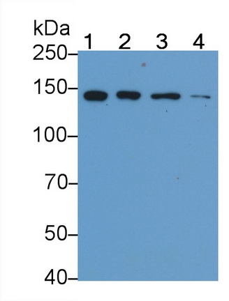 Polyclonal Antibody to Tumor Necrosis Factor Receptor Superfamily, Member 21 (TNFRSF21)
