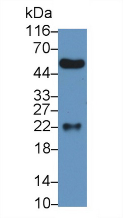 Polyclonal Antibody to Peptidoglycan Recognition Protein 1 (PGLYRP1)