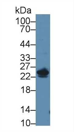 Polyclonal Antibody to 5',3'-Nucleotidase, Cytosolic (NT5C)