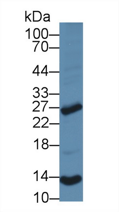 Polyclonal Antibody to 5',3'-Nucleotidase, Cytosolic (NT5C)