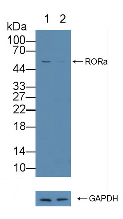Polyclonal Antibody to RAR Related Orphan Receptor Alpha (RORa)