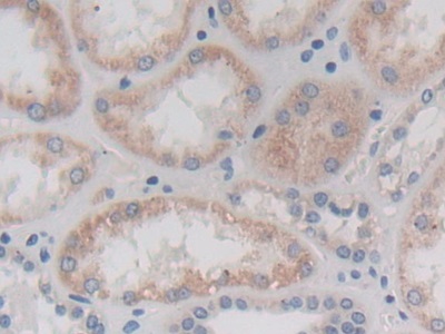 Polyclonal Antibody to Chymotrypsinogen B1 (CTRB1)