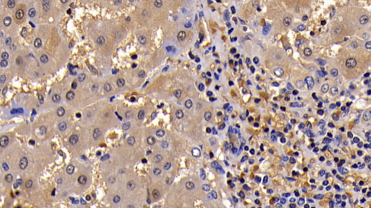 Polyclonal Antibody to B-Cell CLL/Lymphoma 2 Like Protein (Bcl2L)