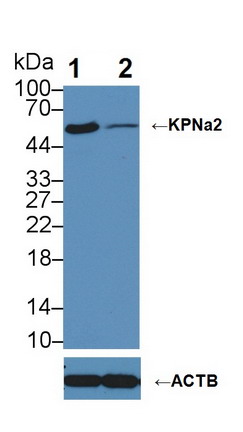Polyclonal Antibody to Karyopherin Alpha 2 (KPNa2)