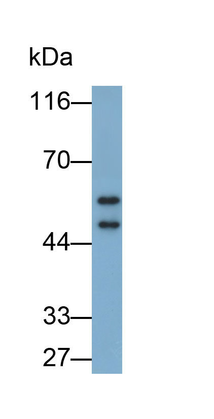 Polyclonal Antibody to Annexin A7 (ANXA7)