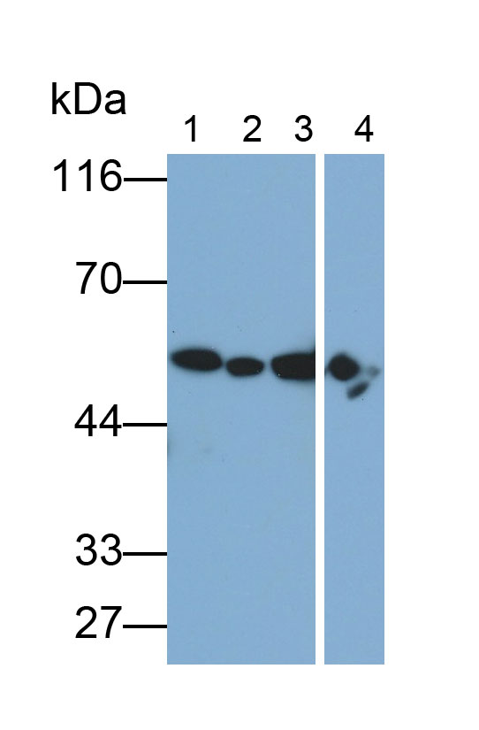 Polyclonal Antibody to Aldehyde Dehydrogenase 1 Family, Member A1 (ALDH1A1)