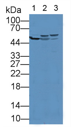 Polyclonal Antibody to Aldehyde Dehydrogenase 7 Family, Member A1 (ALDH7A1)
