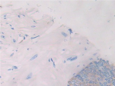Polyclonal Antibody to Interleukin 1 Zeta (IL1z)