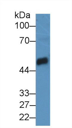 Polyclonal Antibody to Carboxypeptidase B1, Tissue (CPB1)