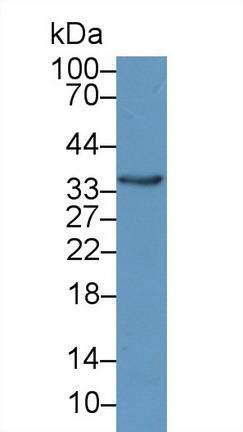 Polyclonal Antibody to Crystallin Lambda 1 (CRYl1)