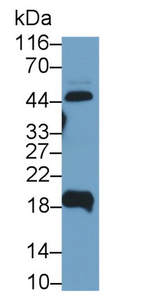 Polyclonal Antibody to Uroplakin 2 (UPK2)