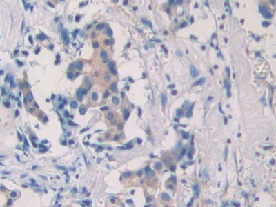 Polyclonal Antibody to Septin 5 (SEPT5)