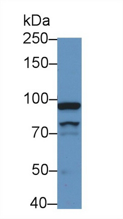 Polyclonal Antibody to Ribonucleotide Reductase M1 (RRM1)