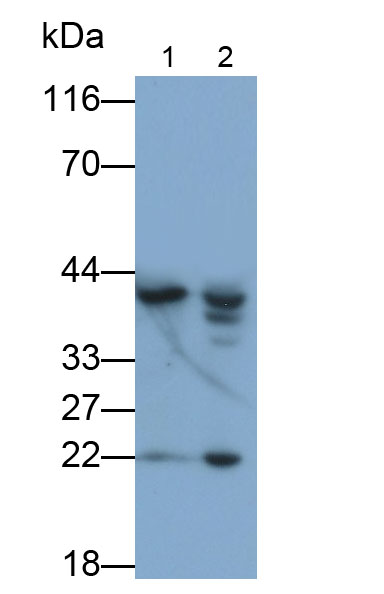 Polyclonal Antibody to G Protein Coupled Estrogen Receptor 1 (GPER)