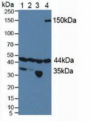 Polyclonal Antibody to Hypoxia Inducible Factor 1 Alpha Subunit Inhibitor (HIF1aN)