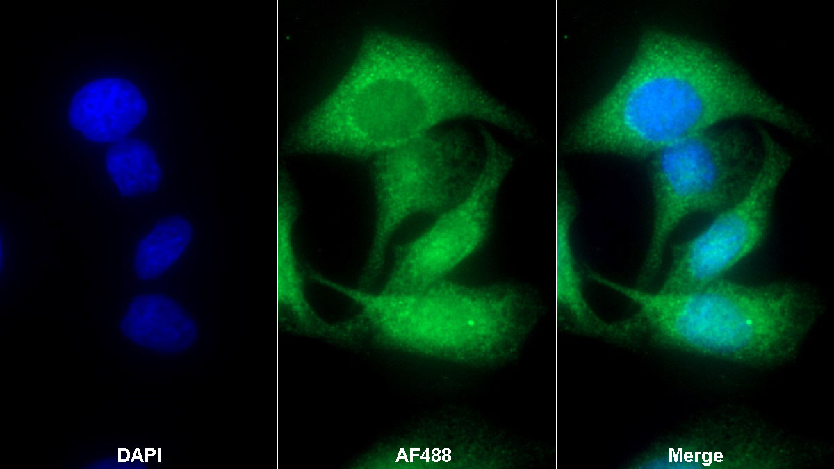 Polyclonal Antibody to Microtubule Associated Protein RP/EB Family, Member 1 (MAPRE1)