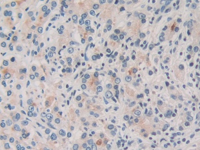 Polyclonal Antibody to Torsin 1A (TOR1A)