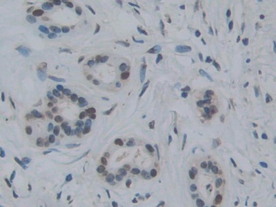 Polyclonal Antibody to Torsin 1A (TOR1A)