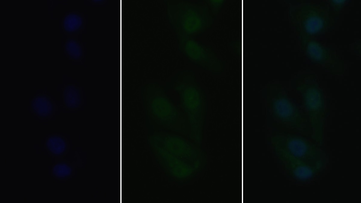 Polyclonal Antibody to TNF Receptor Associated Factor 6 (TRAF6)