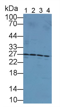 Polyclonal Antibody to Ubiquitin Carboxyl Terminal Hydrolase L3 (UCHL3)