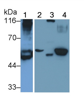 Polyclonal Antibody to Serine/Threonine Kinase 11 (STK11)