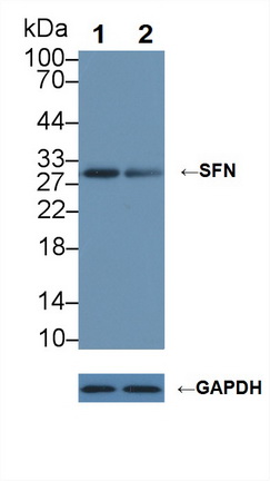 Polyclonal Antibody to Stratifin (SFN)