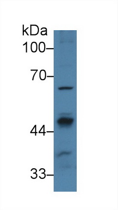 Polyclonal Antibody to Protein Phosphatase, Mg2+/Mn2+ Dependent 1A (PPM1A)