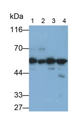 Polyclonal Antibody to 3-Oxoacid Coenzyme A Transferase 1 (OXCT1)