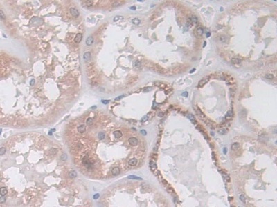 Polyclonal Antibody to Isocitrate Dehydrogenase 2, mitochondrial (IDH2)