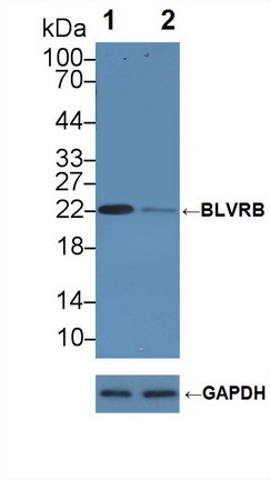 Polyclonal Antibody to Biliverdin Reductase B (BLVRB)