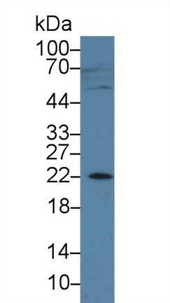 Polyclonal Antibody to Amelogenin, X-Linked (AMELX)