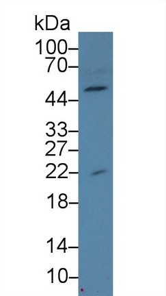 Polyclonal Antibody to Amelogenin, X-Linked (AMELX)