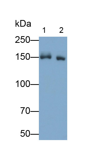 Polyclonal Antibody to Zinc Finger Homeobox Protein 1B (ZFHX1B)