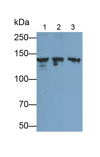 Polyclonal Antibody to Phosphoinositide-3-Kinase Catalytic Beta Polypeptide (PIK3Cb)