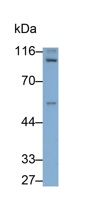 Polyclonal Antibody to Angiogenic Factor With G Patch And FHA Domains 1 (AGGF1)